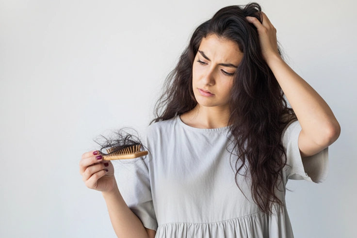 Early signs of hair loss with thinning hair and receding hairline highlighting scalp condition