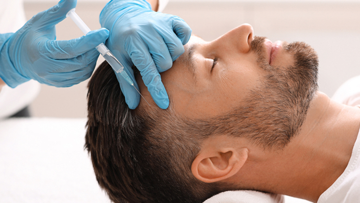 Advanced Exosome GFC Treatment for Hair Restoration Boost hair regrowth with innovative Exosome GFC therapy for stronger, healthier hair.