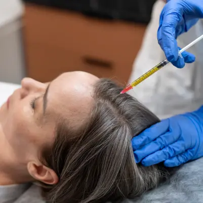 Best Platelet Rich Plasma Treatment in Coimbatore, Tamilnadu A doctor wearing gloves injects a woman's head for platelet-rich plasma hair transplant treatments.