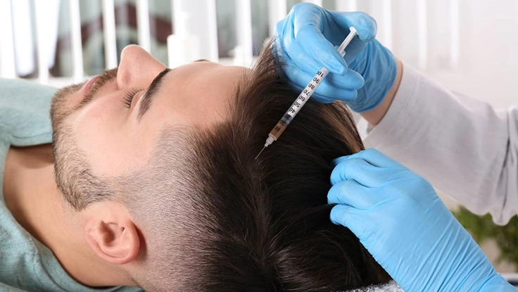 Best Hair Transplant Clinic in Gandhipuram, Coimbatore Restore your confidence with Sapphire & Bio FUE Hair Treatment for effective hair regrowth and care.