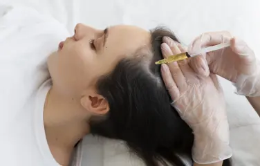 While wearing white gloves, a doctor injects a woman with GFC Pro to increase her hair growth.