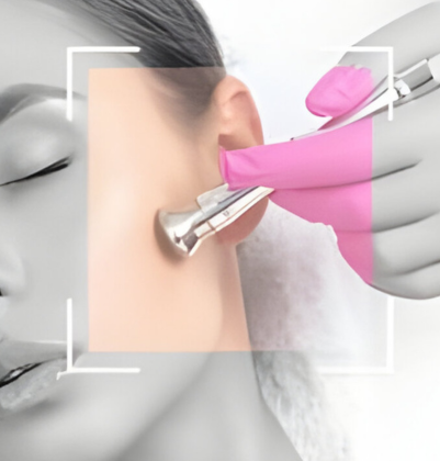 A woman receiving a microdermabrasion facial treatment wearing a pink glove in a clean setting.
