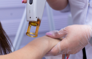 The advanced laser technology of ND Yag Laser Treatment emits specific wavelengths of light.