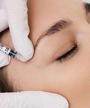 Crow’s feet Botox treatment to reduce fine lines near the eyes, keeping the area smooth and natural-looking