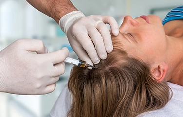 Tri Cell PRP treatment in Cumbum encourages thicker hair growth, fuller coverage and healthy scalp.