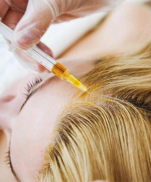 TriCell PRP therapy supports complete scalp health and boosts hair regrowth across the entire scalp in Karur.