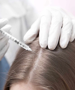 Targeted TriCell PRP treatment for mid-part line and diffuse hair thinning restoration in Karur.