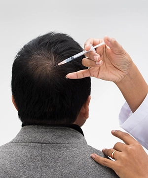 TriCell PRP improves crown area by boosting hair density and reversing early baldness naturally.