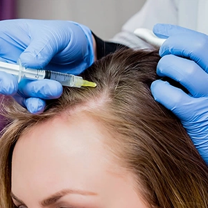 Tri-Cell PRP for Full Scalp Health & Hair Retention in Pudukkottai Tri-Cell PRP boosts scalp circulation, nourishes roots, and delays future hair thinning.
