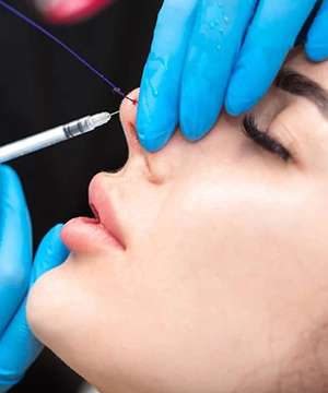 Bunny lines Botox treatment to reduce nose creases, smooth upper-face wrinkles, and improve expression lines