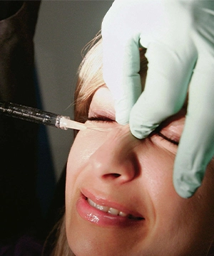 Bunny lines Botox treatment to reduce nose creases, smooth upper-face wrinkles, and improve expression lines