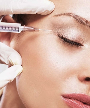 Crow’s feet Botox treatment to reduce fine lines near the eyes, keeping the area smooth and natural-looking