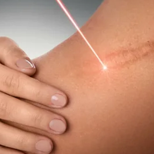 GFC scar repair smooths old scars, enhances skin clarity and supports healthy, clear skin renewal.