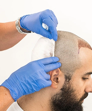 Accelerate healing and hair growth after transplant with post PRP restoration care in Sivakasi.