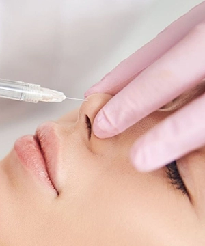 Bunny lines Botox treatment to reduce nose creases, smooth upper-face wrinkles, and improve expression lines