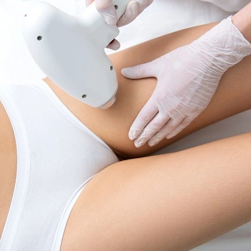 Bikini Line Laser Hair Removal For Hygiene Care, Tharamani