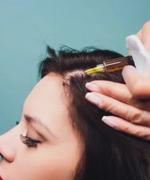 Regain crown area volume using powerful Y Cell PRP hair regrowth solutions for improvement in Tharamani.