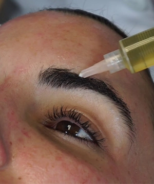 Enhance eyebrow fullness with transplant care for defined, naturally shaped brows done in Tharamani.