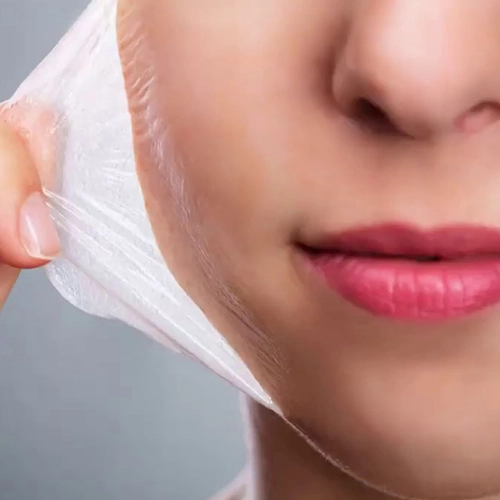 Face Chemical Peels remove dull layers, brighten skin tone, smooth texture & give clear skin, Tharamani.