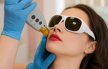 Effective Q-Switch laser treatment in Tharamani to remove pigmentation, dark spots, and improve skin tone.