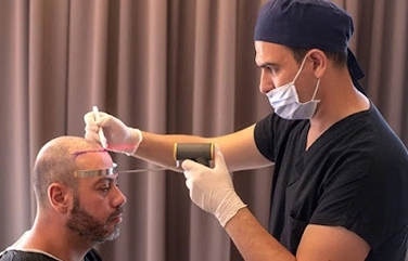 SHI hair implant and transplant in Tharamani restores natural hairline with safe advanced techniques.