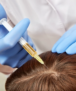 Restore receding hairline with Y Cell PRP hair therapy for fuller and healthy hair strands in Tharamani.