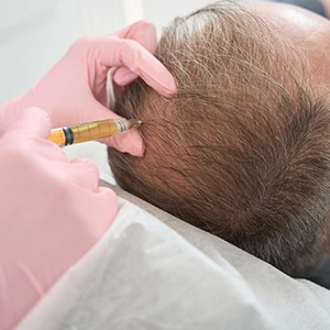 Tri-Cell PRP targets crown bald spots, restores volume, density and overall hair coverage.