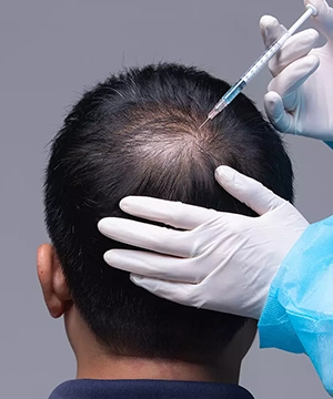 TriCell PRP Crown Bald Spot Hair Regrowth Clinic in Trichy TriCell PRP targets crown bald spots, boosts overall hair volume for men and women.