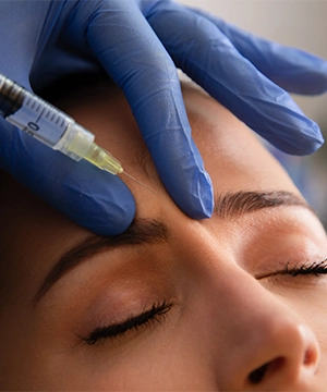 Glabella Botox treatment reduces frown lines between eyebrows and softens tension from stress