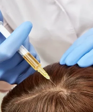 TriCell PRP Hairline Restoration Treatment for Thinning Hair, Trichy TriCell PRP fills receding hairlines, restores natural style for healthy front hairline.